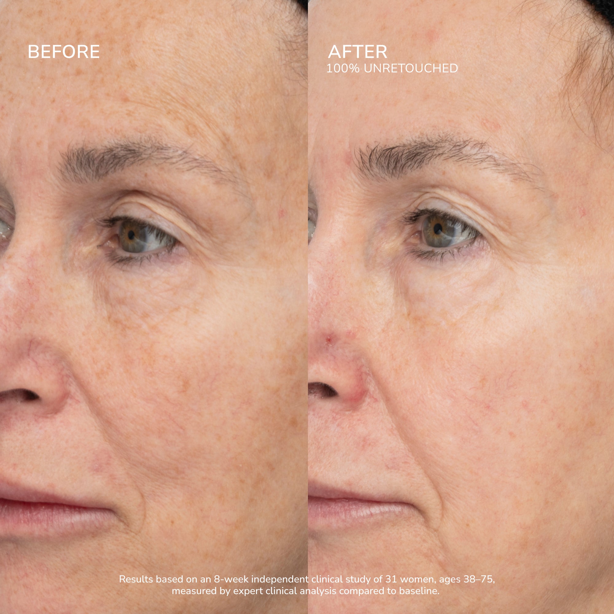 Lipsense SeneCell SenePlex concentrato viso idratante
