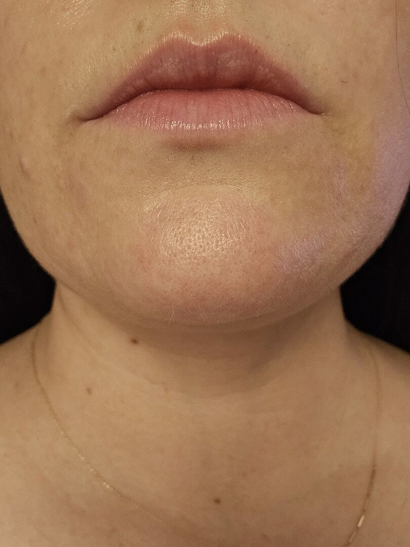 Lipsense Lips Lip Line Corrector siero contorno labbra