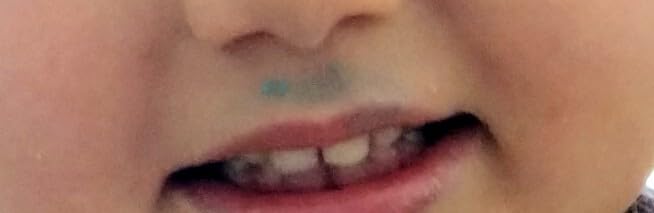 Lip Smacker Disney Frozen balsamo labbra Elsa lampone