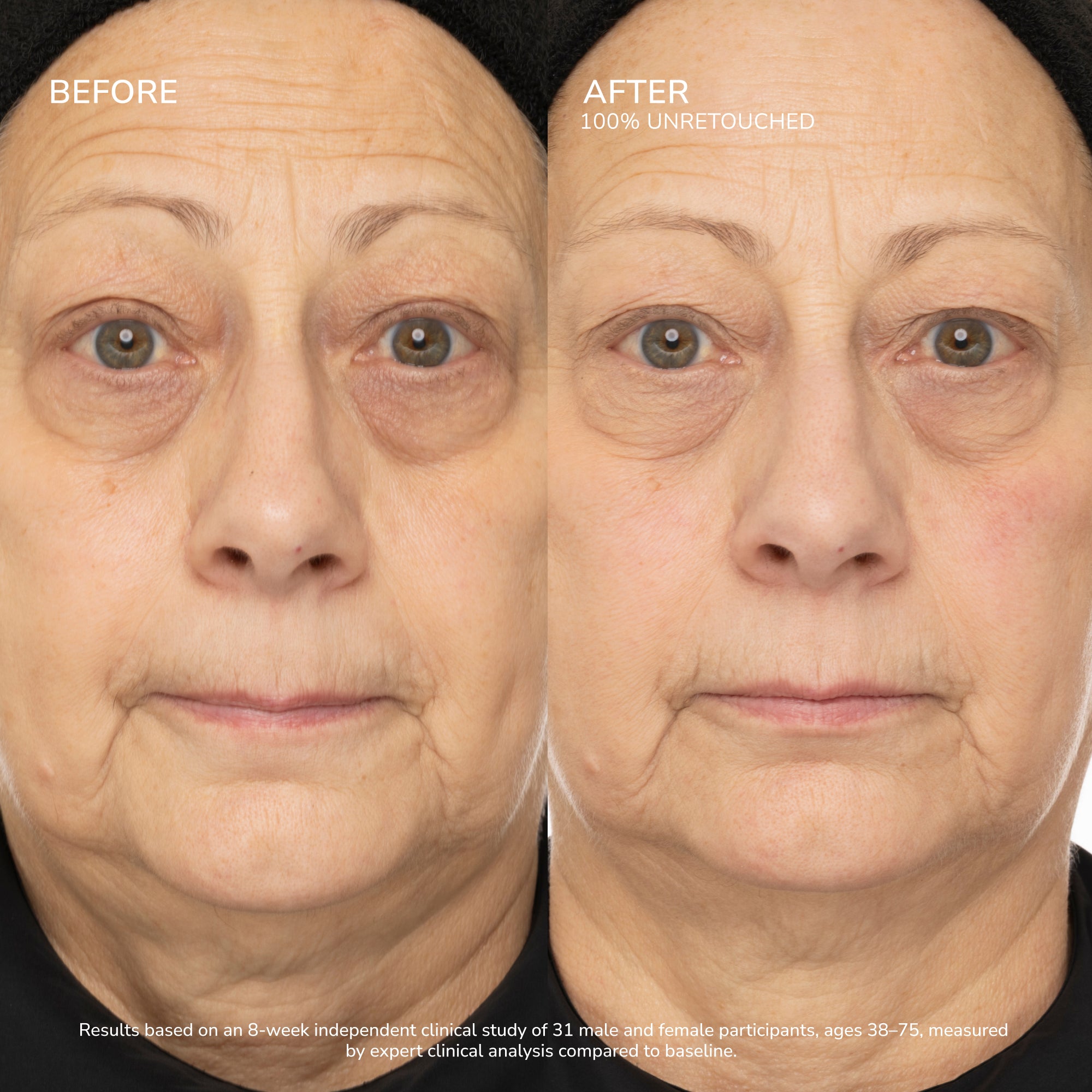 Lipsense GLP-Complex siero viso rassodante