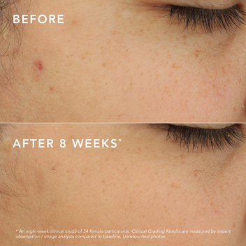 LipSense Skincare C-Bright Siero antimacchia vitamina C