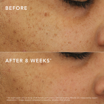 LipSense Skincare C-Bright Siero antimacchia vitamina C